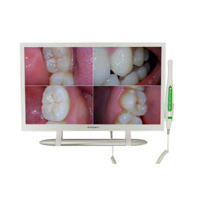 Sistema de cámara intraoral multifuncional dental YF2200M con monitor de 22 pulgadas