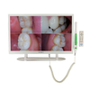 Sistema de cámara intraoral multifuncional dental YF2200M con monitor de 22 pulgadas